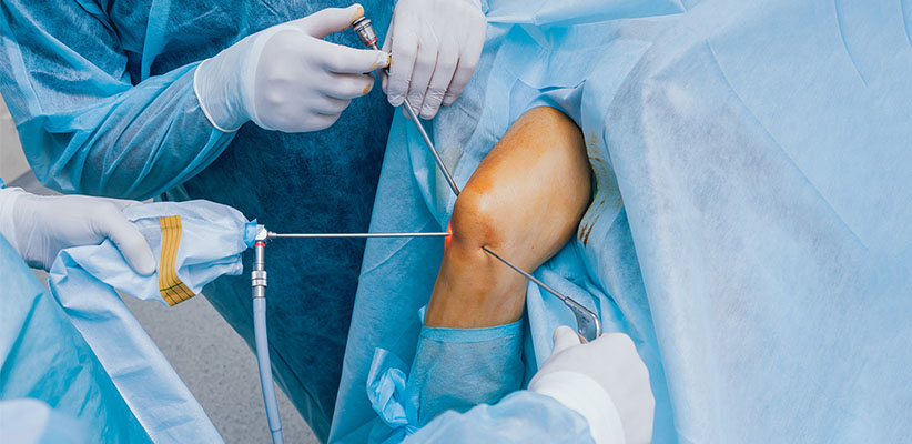Knee Arthroscopy Surgeon in Ahmedabad, Gujarat, Rajasthan